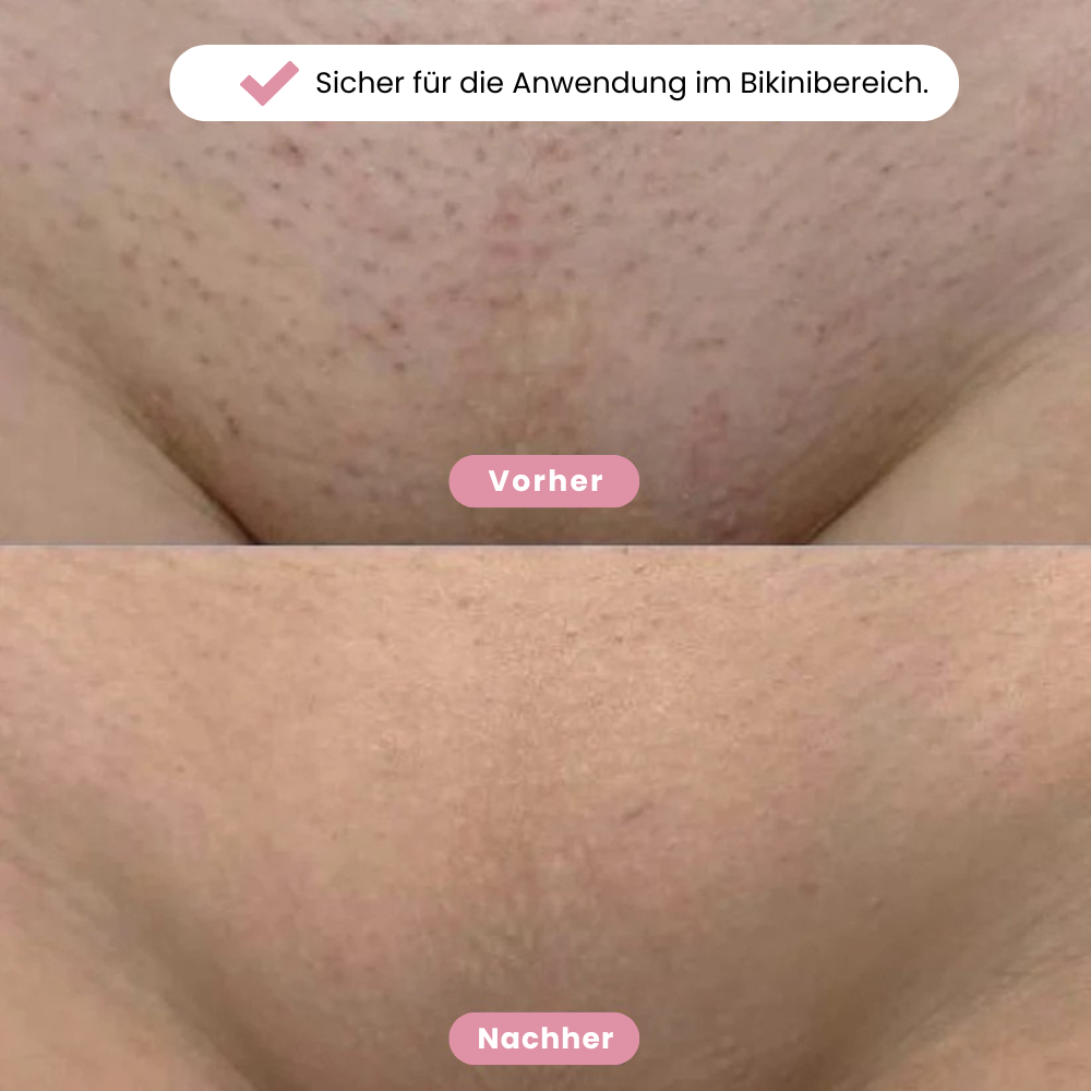 Eulacty™ Bikini-Trimmer