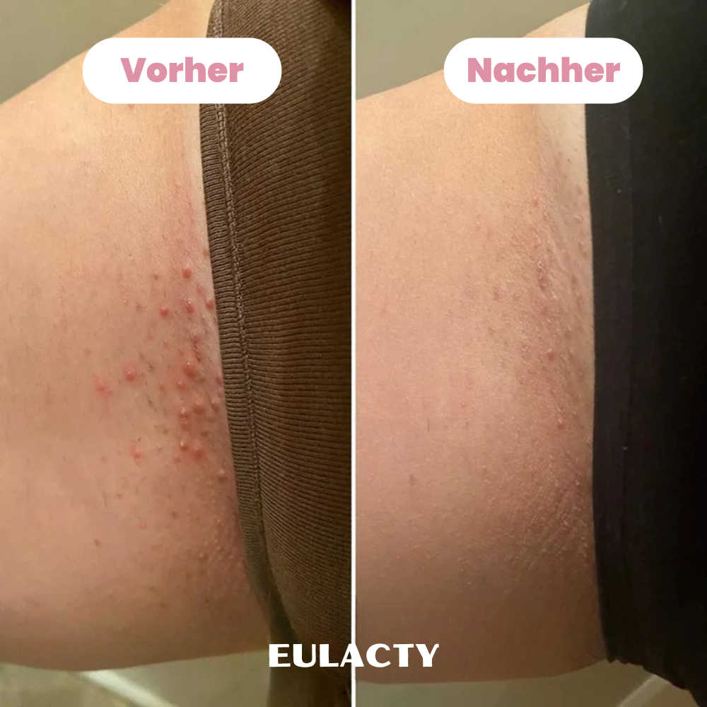 Eulacty™ Bikini-Trimmer