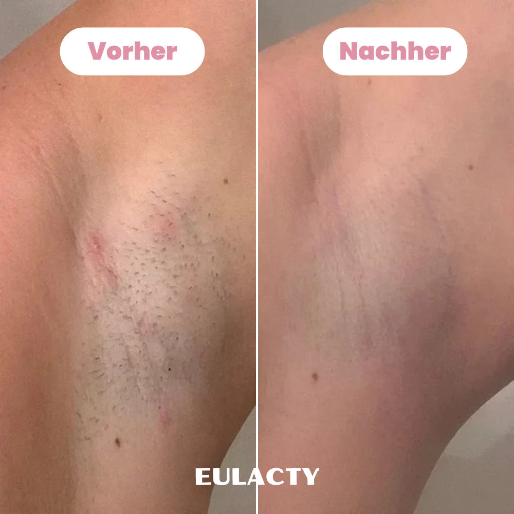 Eulacty™ Bikini-Trimmer